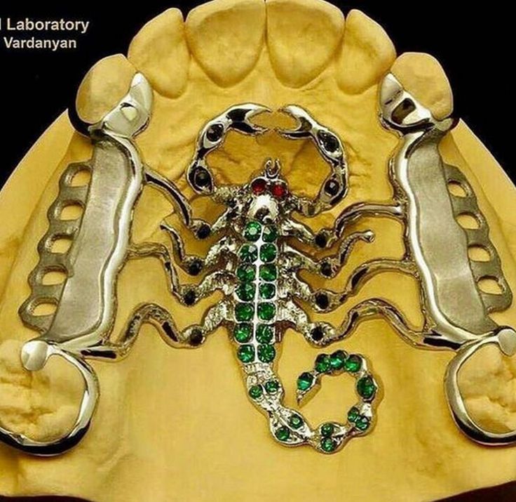 Upper Grills